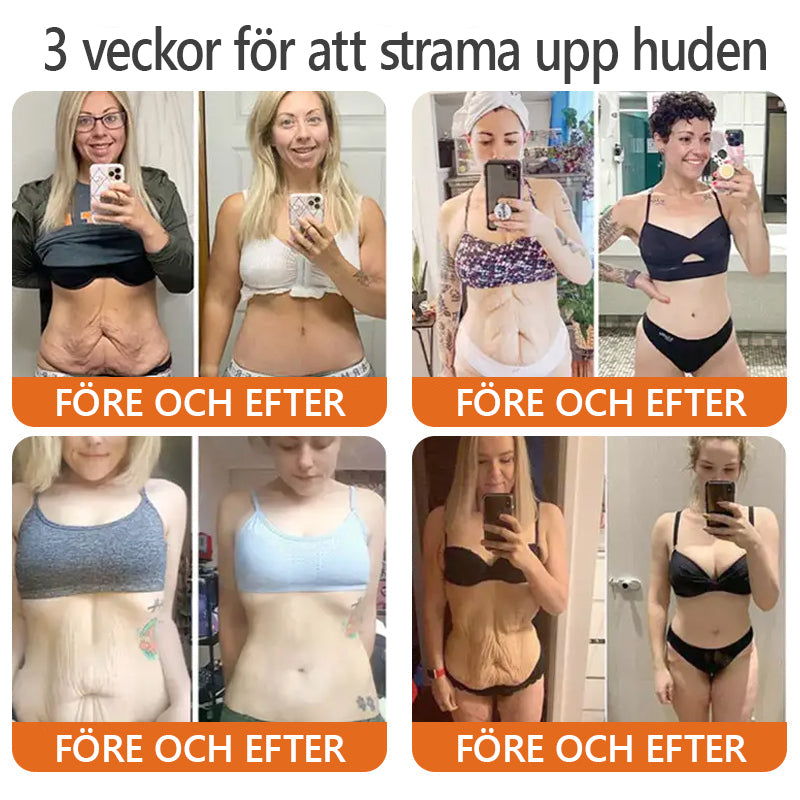 Tillverkad och skickas från Sverige ✨ Awzlove™ Botox Bigift Stramande Serumsticka (🔥SISTA DAGEN – 70% RABATT)