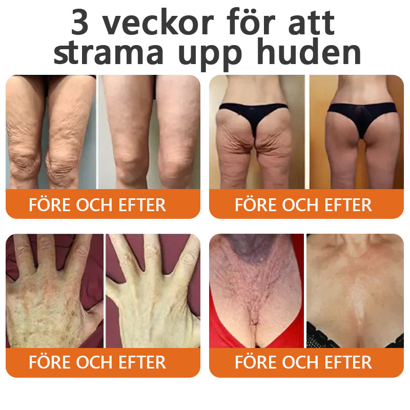 Tillverkad och skickas från Sverige ✨ Awzlove™ Botox Bigift Stramande Serumsticka (🔥SISTA DAGEN – 70% RABATT)
