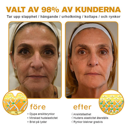 Tillverkad och skickad från Sverige🌟 Awzlove™ Botox Bigift Rynkborttagningskräm🌟 - 🔥 SISTA DAGEN 70 % RABATT