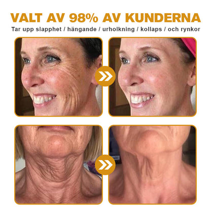 Tillverkad och skickad från Sverige🌟 Awzlove™ Botox Bigift Rynkborttagningskräm🌟 - 🔥 SISTA DAGEN 70 % RABATT