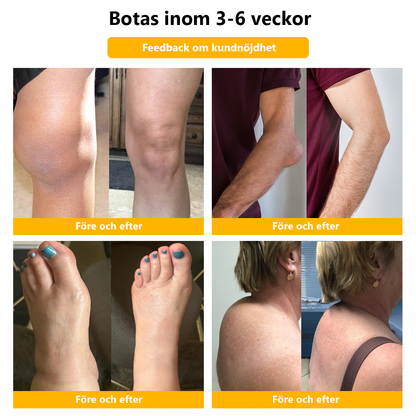 Awzlove™ Bee Venom Gurkmeja Arthritis Therapy Cream (specialiserad på ortopediska tillstånd och ledvärk!🍇