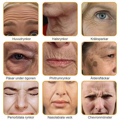 Tillverkad och skickad från Sverige🌟 Awzlove™ Botox Bigift Rynkborttagningskräm🌟 - 🔥 SISTA DAGEN 70 % RABATT