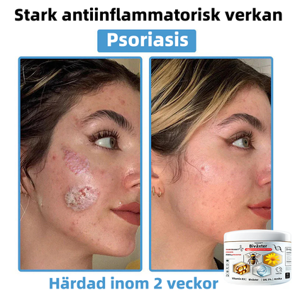 Njut av 30% RABATT när du lägger till den andra🧡
