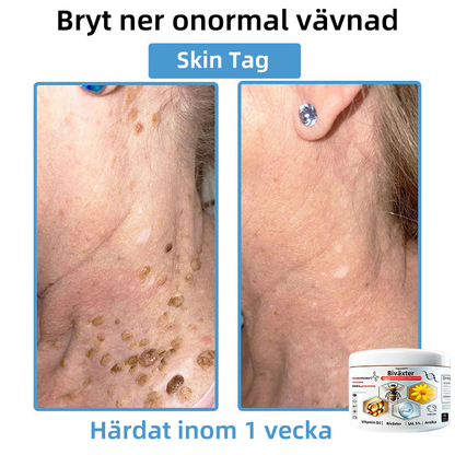 Njut av 30% RABATT när du lägger till den andra🧡